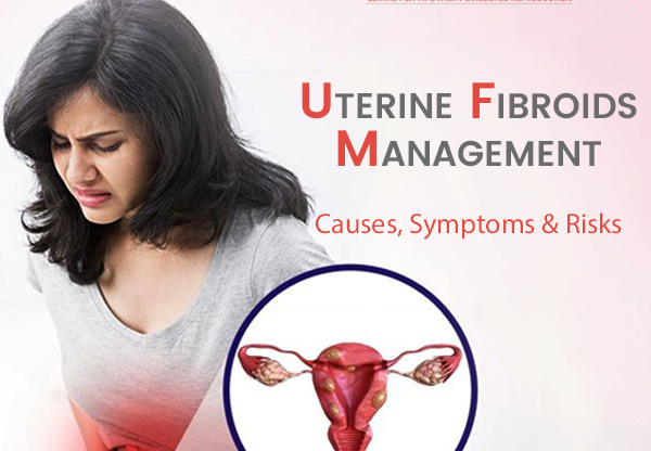 Uterine Fibroid Management: Causes, Symptoms, Treatments, and Risks